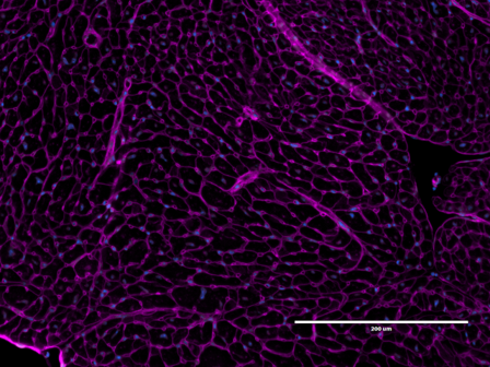 A section of an E15.5 embryo, where the red color corresponds to BMPER+ cells.